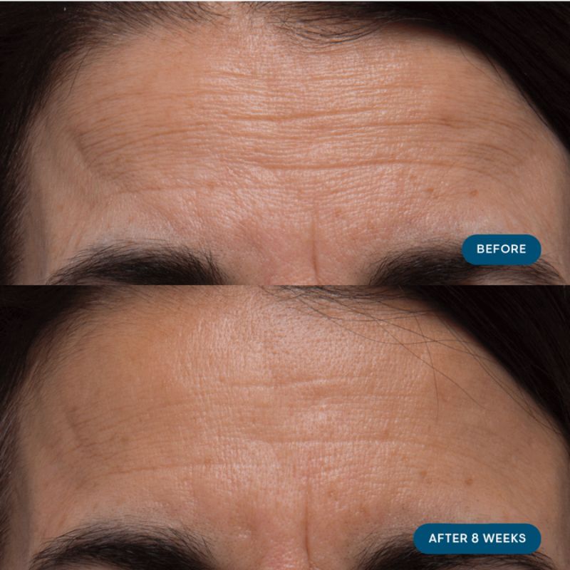 ELEMIS Pro-Collagen Skin Future Supplements