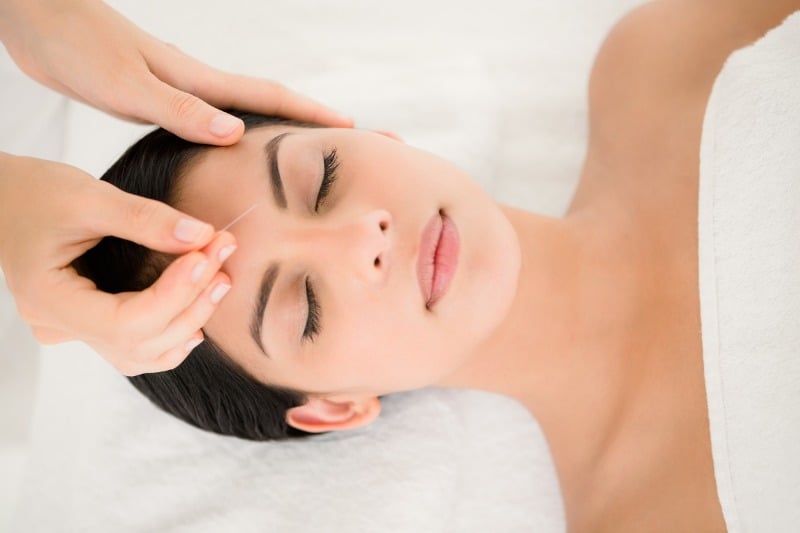 Balancing Your "Qi" With Acupuncture
