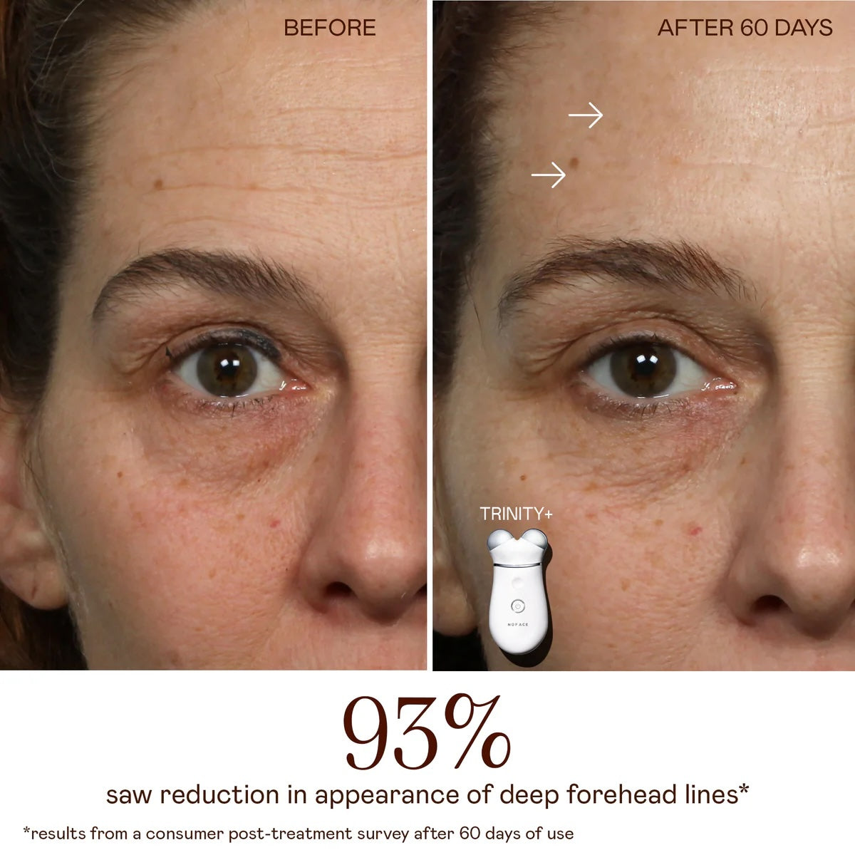 NuFACE Trinity+ LED Red Light Wrinkle Reducer Attachment