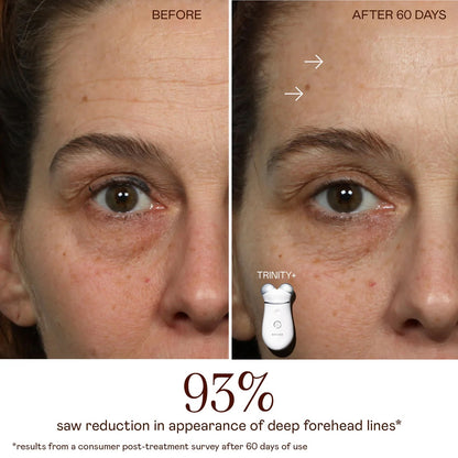 NuFACE Trinity+ LED Red Light Wrinkle Reducer Attachment