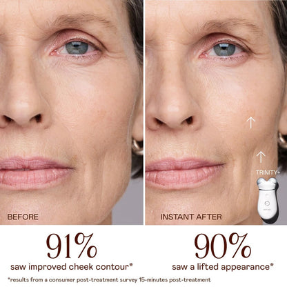 TRINITY+ Lifting & Smoothing Lip & Eye Microcurrent Attachment