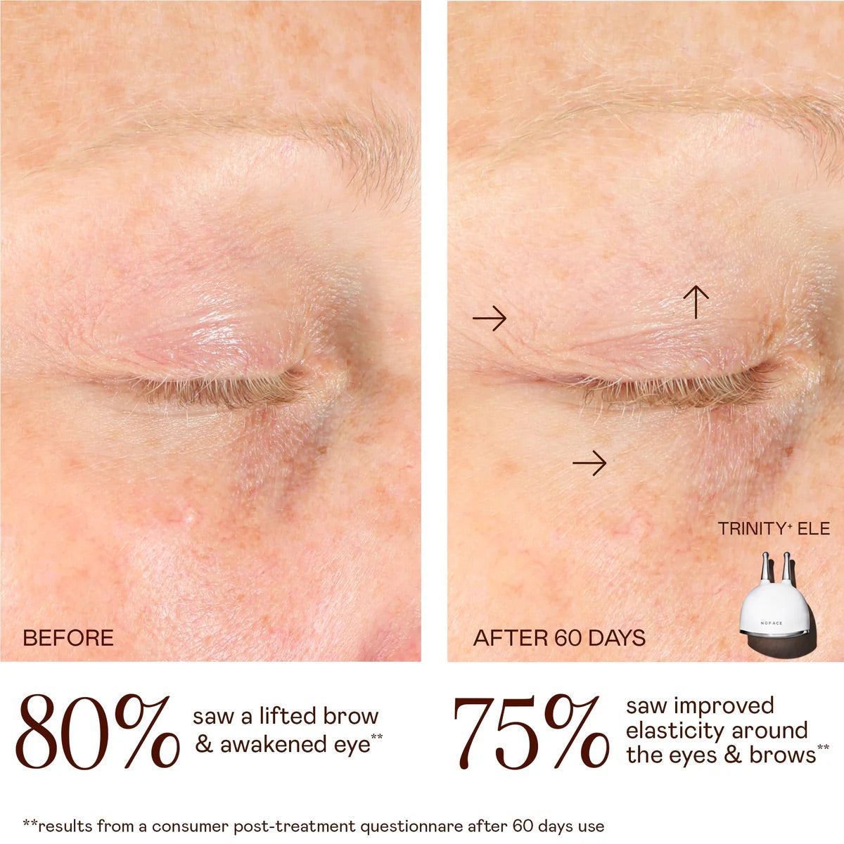 NuFACE TRINITY+ Lifting & Smoothing Lip & Eye Microcurrent