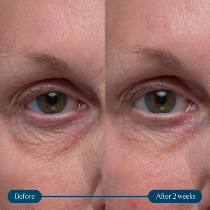 ELEMIS Pro-Collagen Vitality Eye Cream 