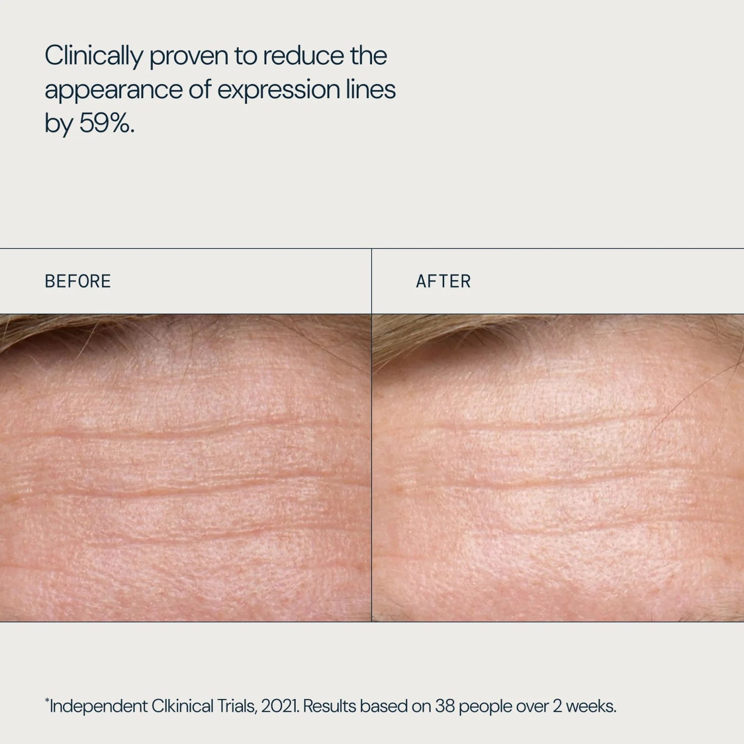 ELEMIS Pro-Collagen Morning Matrix