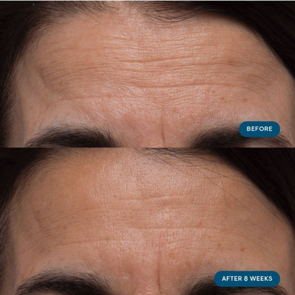 ELEMIS Pro-Collagen Skin Future Supplements 