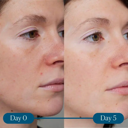 ELEMIS Dynamic Resurfacing Super-C Serum